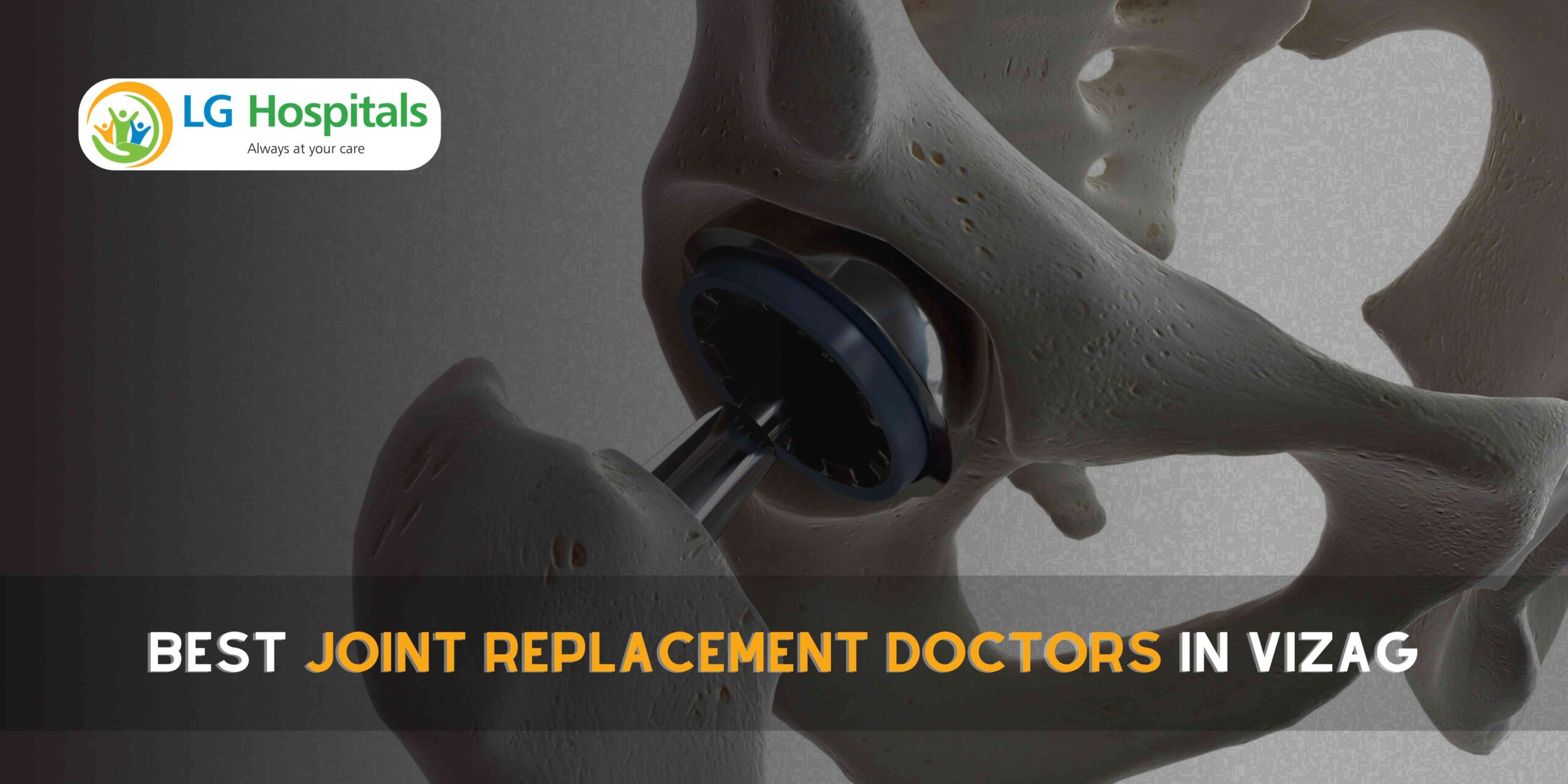 Best Joint Replacement Doctors in Vizag